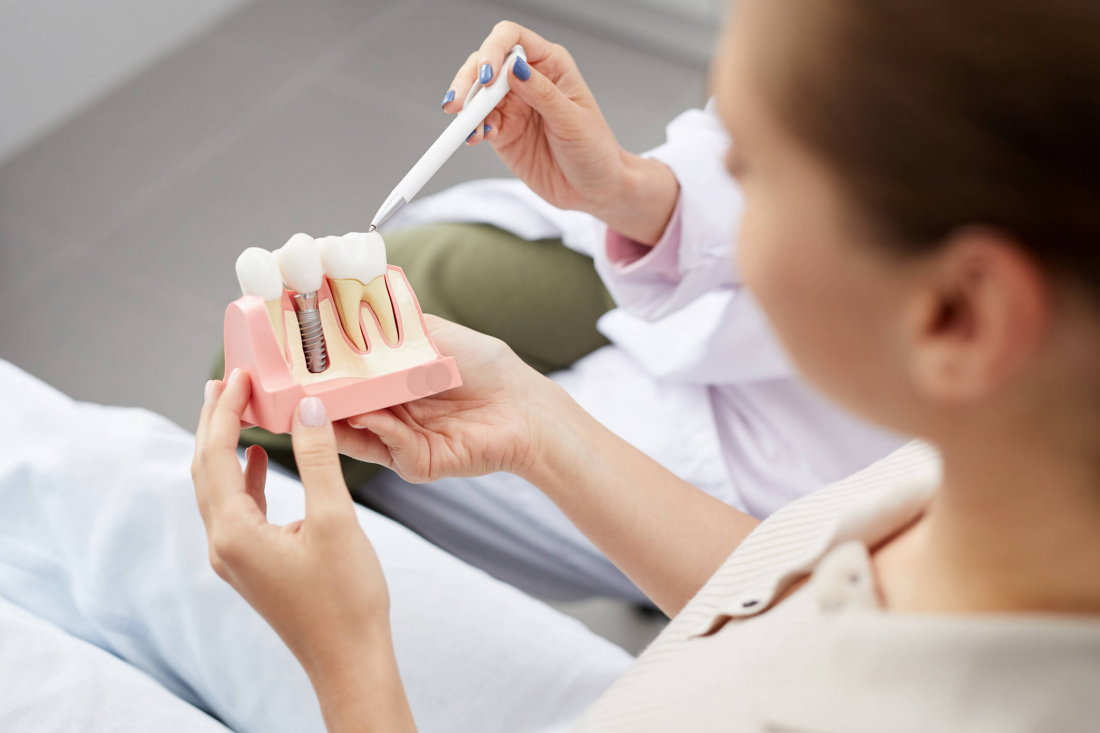 woman holding dental diagram of implants