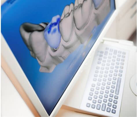 dental scan on computer