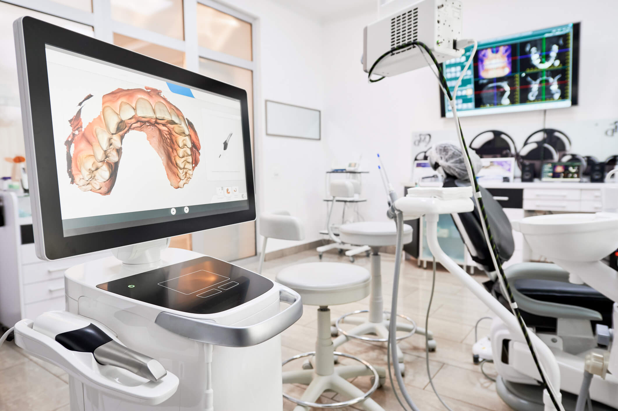 photo of dentist office with 3D model of teeth displayed on computer screen