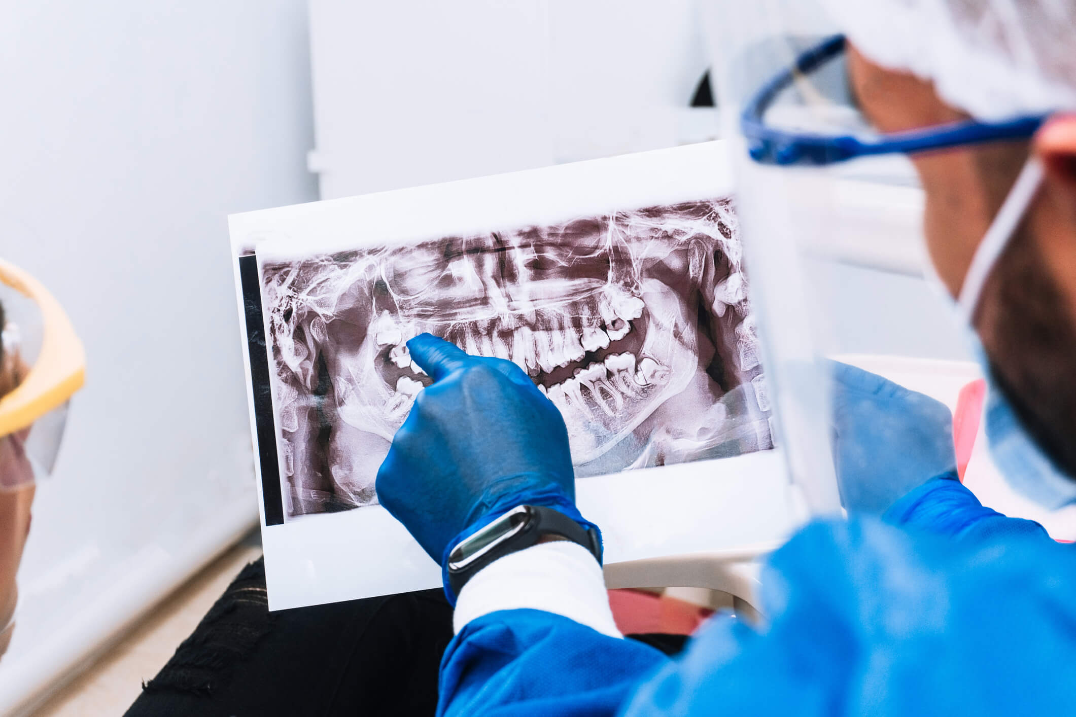 dentist holding x ray of wisdom teeth