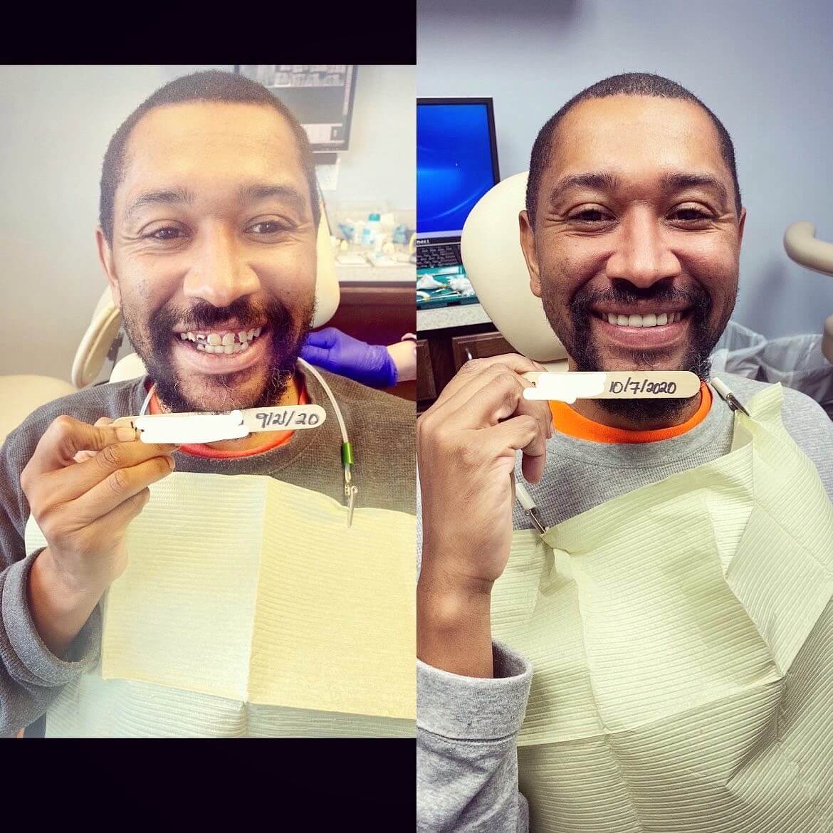 before-and-after-dental-services-three-rivers-dental-group